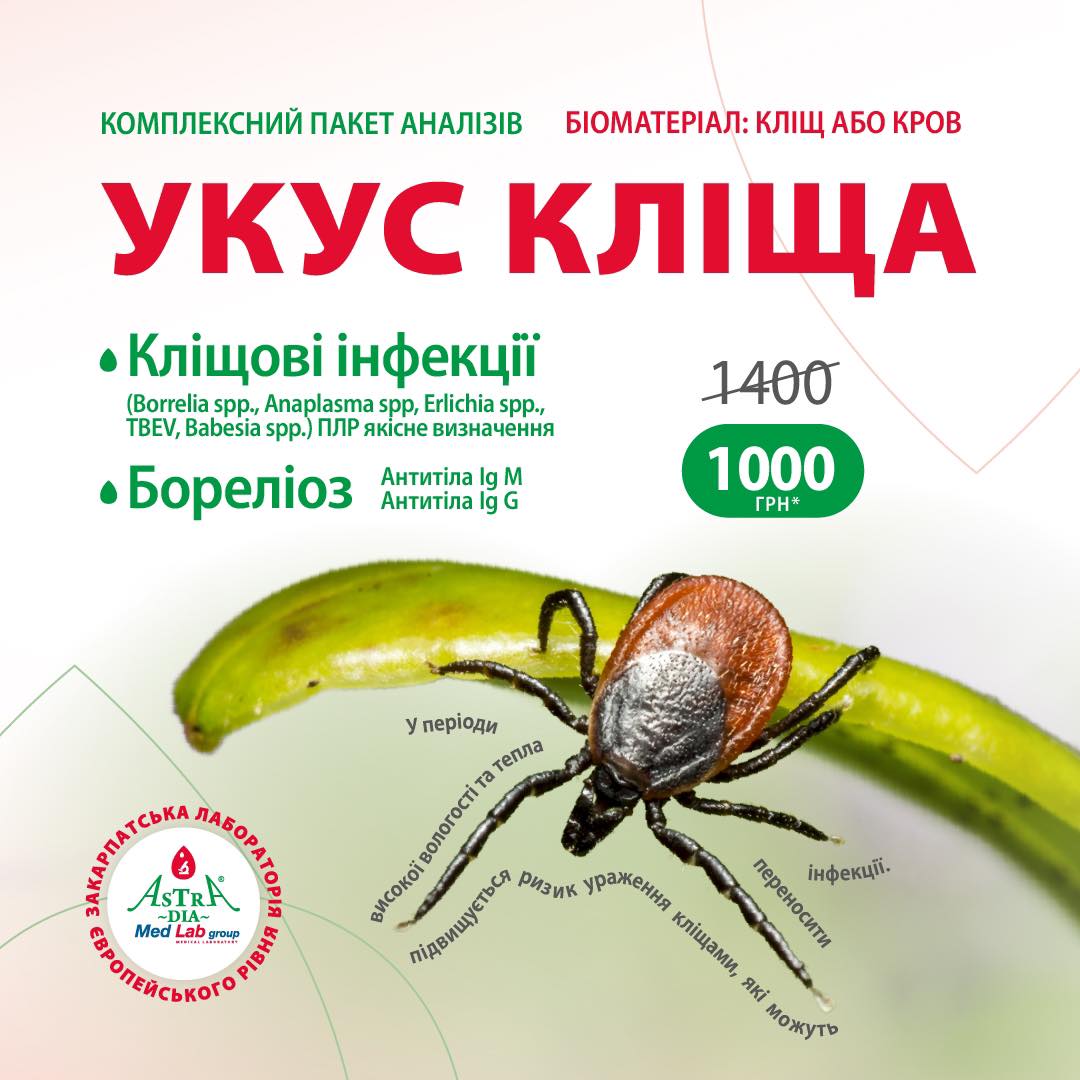 %D0%A3%D0%BA%D1%83%D1%81_%D0%BA%D0%BB%D1%96%D1%89%D0%B0.jpg?1726666009