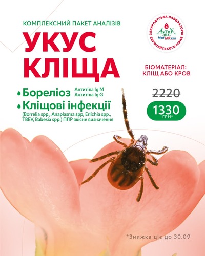%d1%83%d0%ba%d1%83%d1%81 %d0%ba%d0%bb%d1%96%d1%89%d0%b0