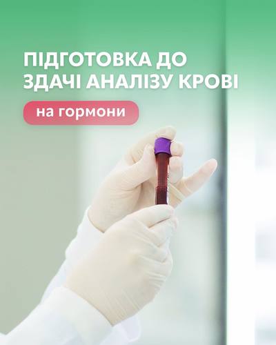 %d0%bf%d1%96%d0%b4%d0%b3%d0%be%d1%82%d0%be%d0%b2%d0%ba%d0%b0 %d0%b4%d0%be %d0%b7%d0%b4%d0%b0%d1%87%d1%96 %d0%b0%d0%bd%d0%b0%d0%bb%d1%96%d0%b7%d1%83 %d0%ba%d1%80%d0%be%d0%b2%d1%96 %d0%bd%d0%b0 %d0%b3%d0%be%d1%80%d0%bc%d0%be%d0%bd%d0%b8
