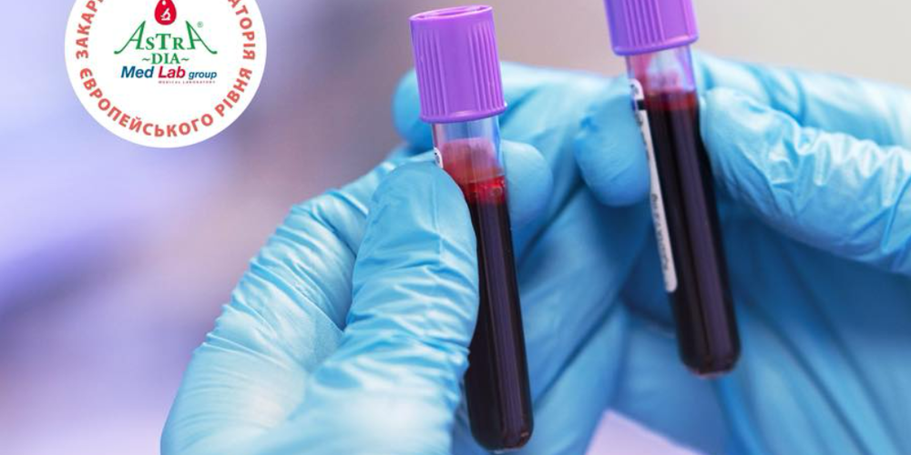 Jak poperedyty tromboz