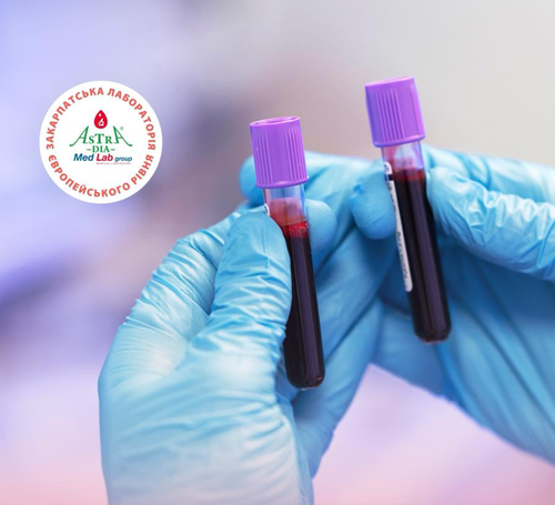 Jak poperedyty tromboz