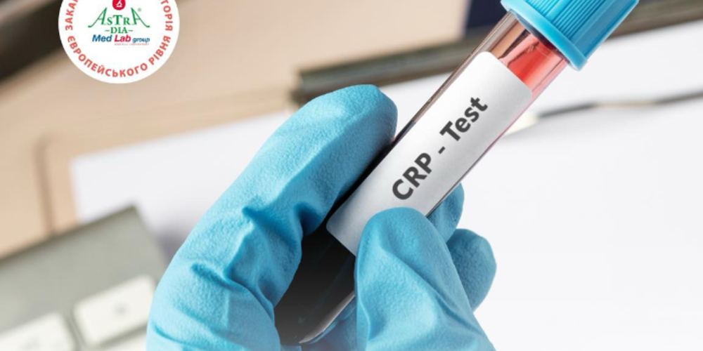 C reactyvnyi bilok photo