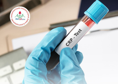 C reactyvnyi bilok photo