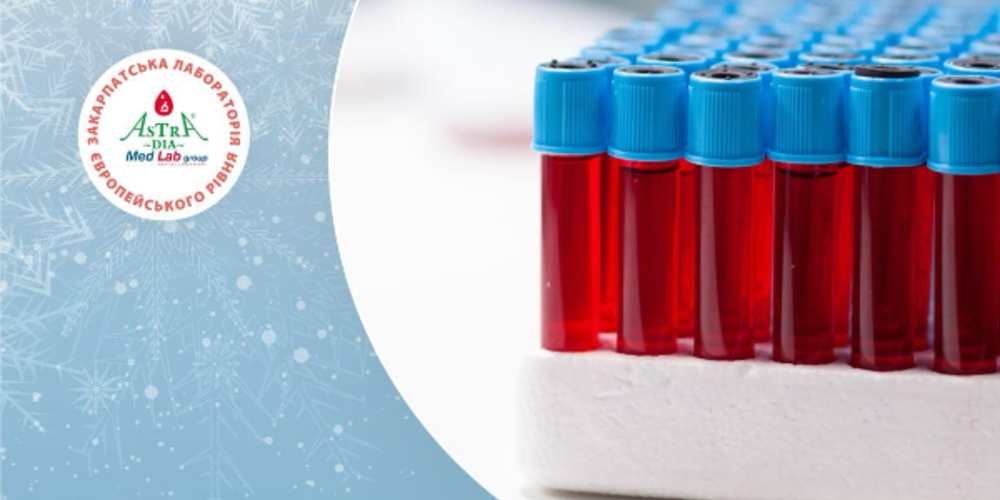 Yak pidhotuvaty organizm do zymy check list analyziv