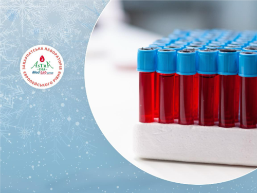 Yak pidhotuvaty organizm do zymy check list analyziv