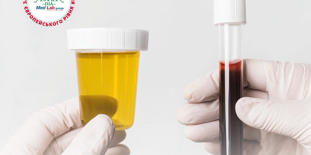 Bilok v sechi ta krovi