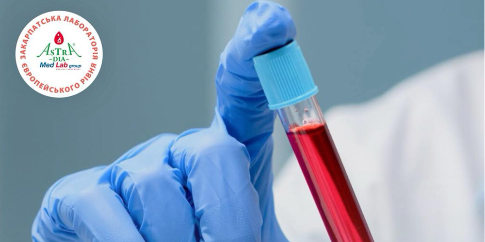 Chomu vazhko shudnuty