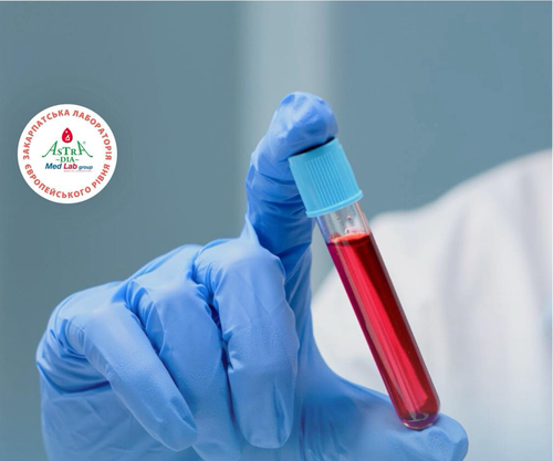 Chomu vazhko shudnuty